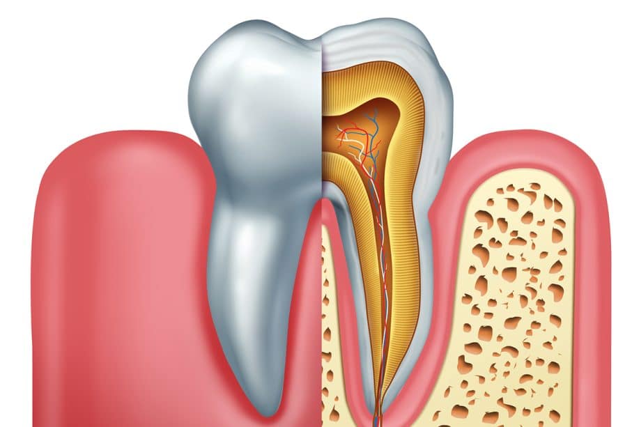 How Do You Know If You Need A Root Canal?